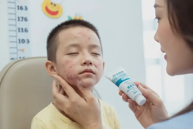 小孩面部经常长湿疹能治好吗(图2)