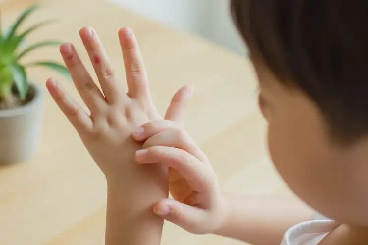 小孩手上偶尔起湿疹能治好吗(图2)