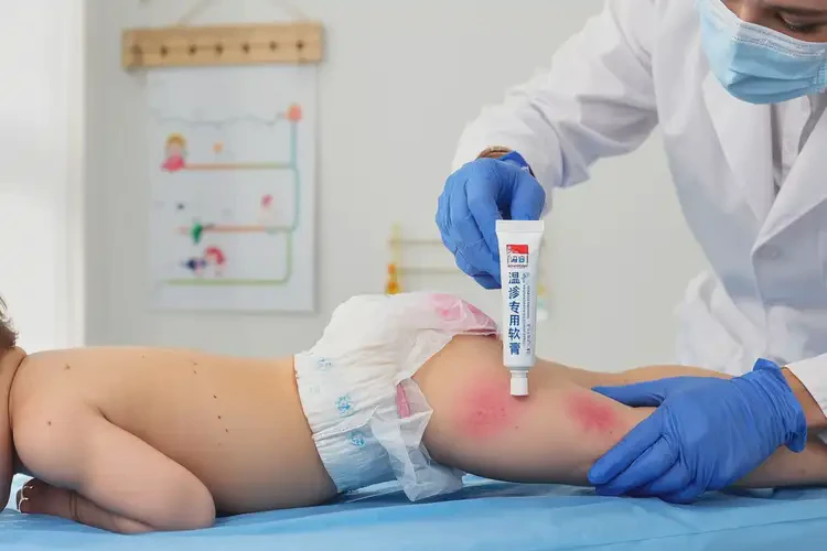 孩子屁股出现湿疹能治好吗(图3)