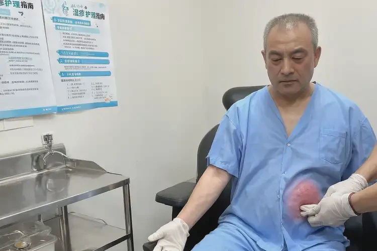 男性屁股上有湿疹能治好吗(图4)