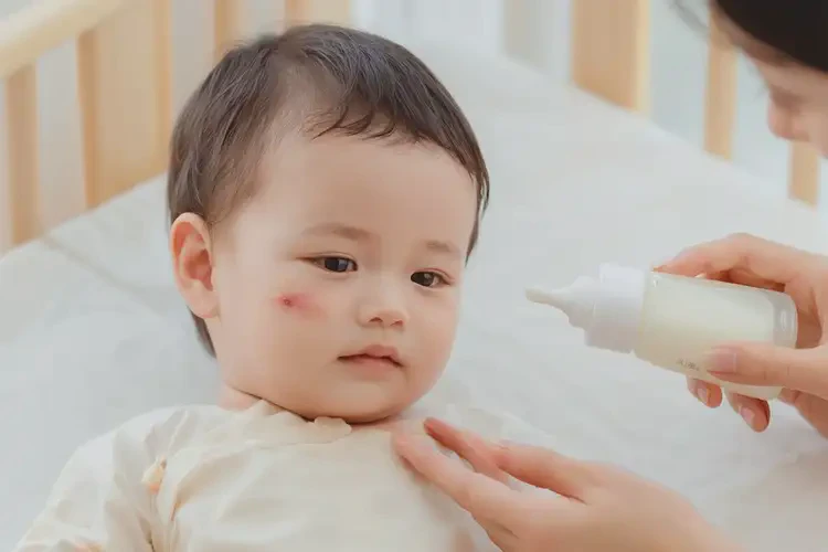 婴幼儿脖子上偶尔起湿疹可不可以彻底自愈(图3)