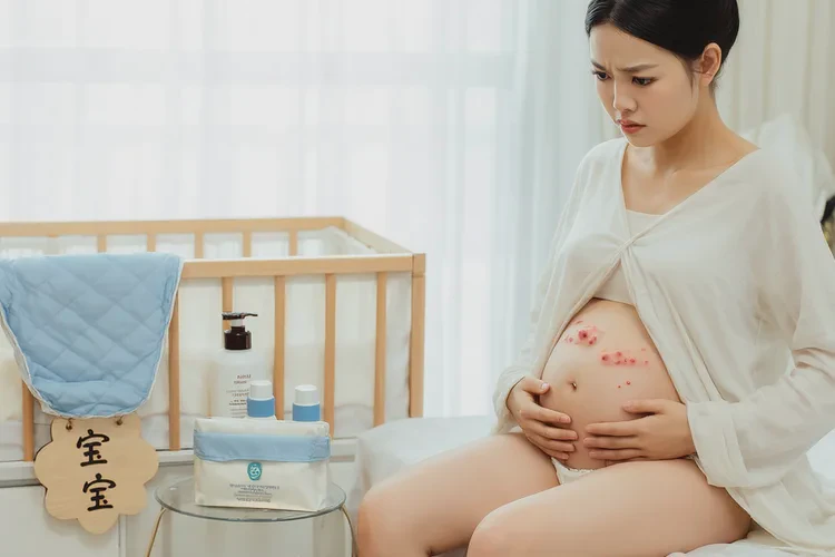 产妇肚子上经常起湿疹可以治愈吗(图1)