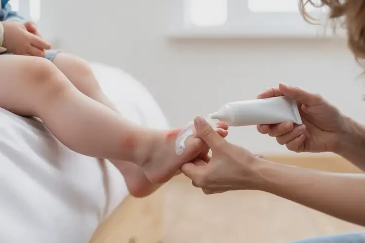 婴幼儿小腿经常起湿疹能治好吗(图3)