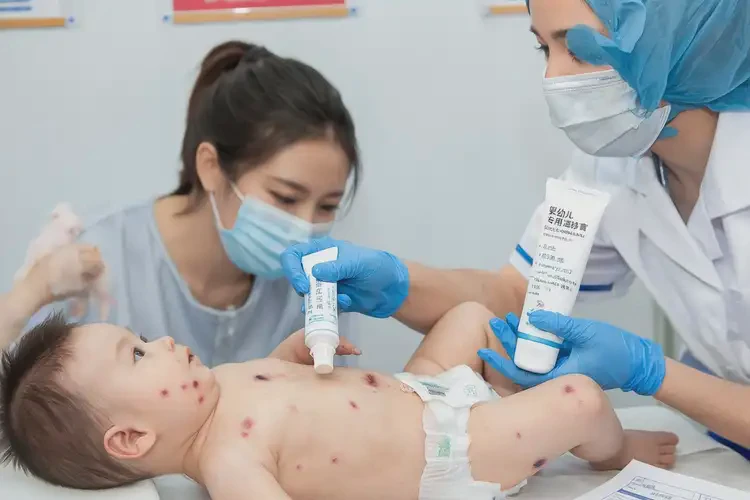 婴幼儿全身出现湿疹能治好吗(图4)