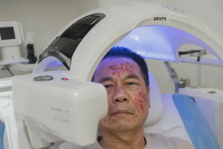 男性面部经常起湿疹能治好吗(图2)