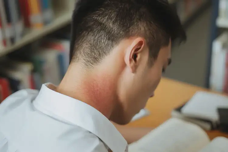 大学生脖子上容易长湿疹可以彻底自愈吗(图2)