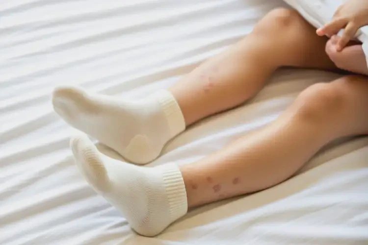 孩子四肢容易长湿疹能治好吗(图1)