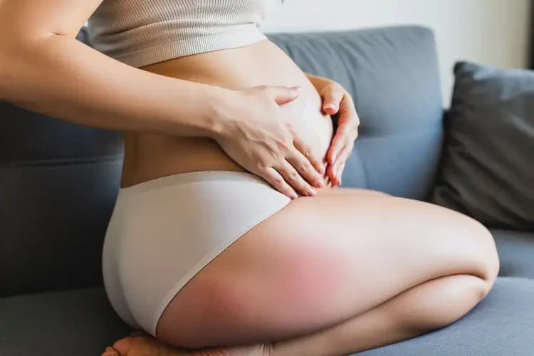 产妇屁股上有湿疹能治好吗(图2)