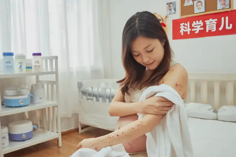产妇手臂上有湿疹能治好吗(图1)