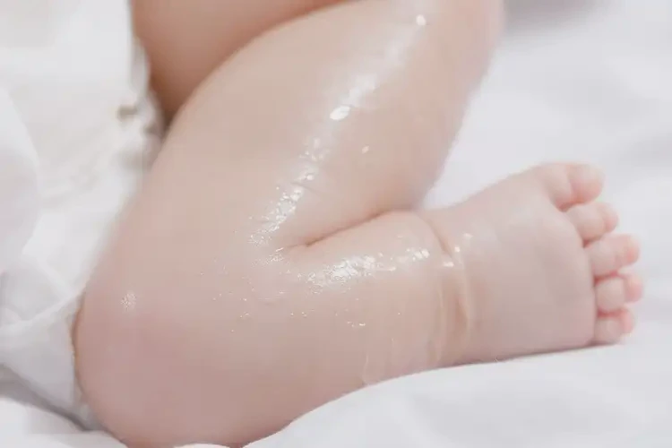 小孩小腿容易起湿疹能治好吗(图1)