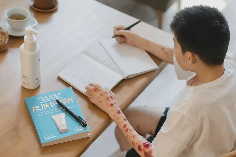 青少年大腿长湿疹能治愈吗(图1)