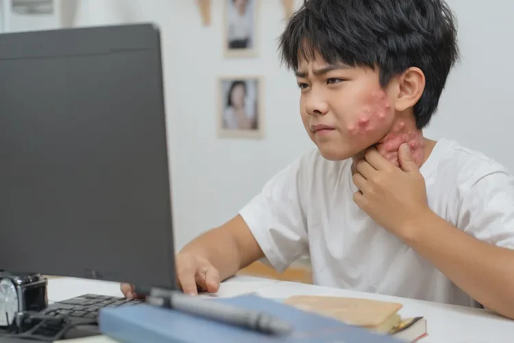 青少年脖子长湿疹能治愈吗(图1)