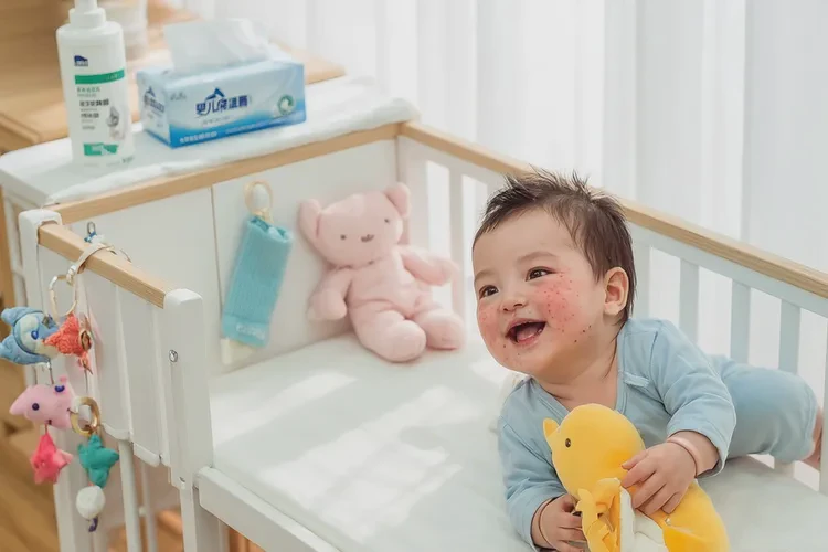 新生儿脸上经常长湿疹能治愈吗(图3)