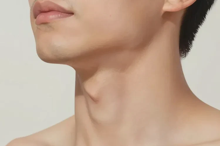 男人脖子上经常起湿疹能治愈吗(图2)