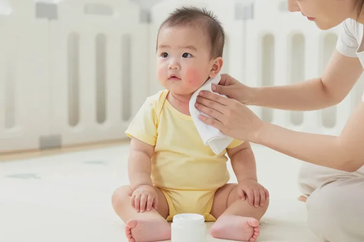 婴儿脖子上有湿疹能不能治愈(图4)