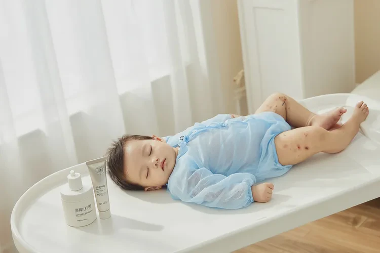 婴儿小腿上经常起湿疹能不能治愈(图4)