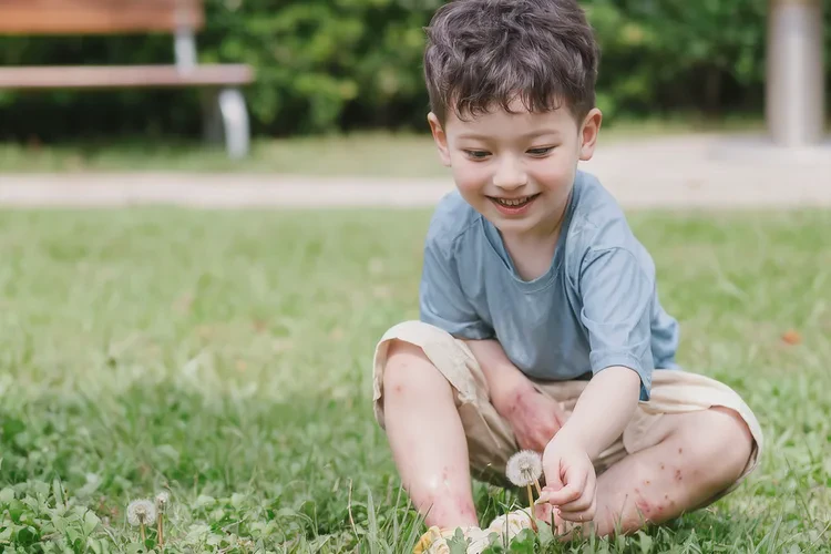 儿童肚子出现湿疹能够根治吗(图3)