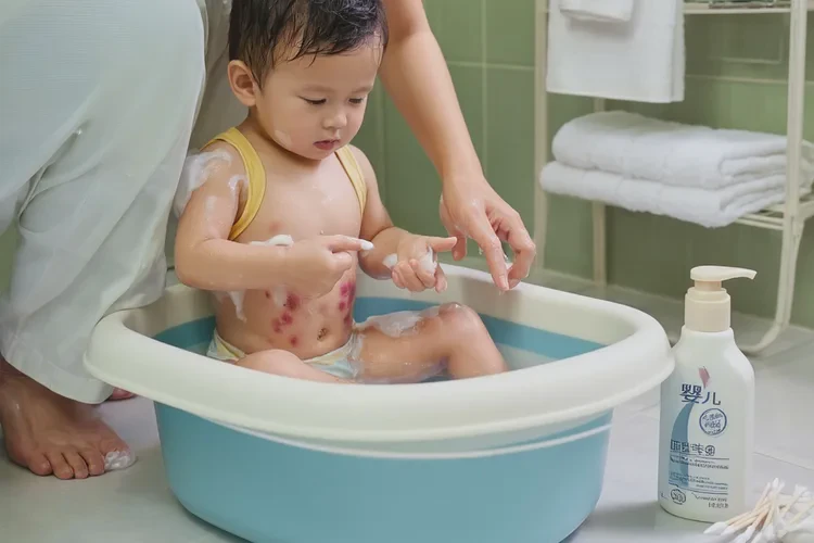 儿童肚子出现湿疹能够根治吗(图2)