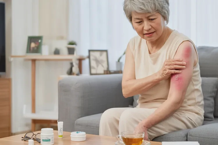 老年人全身经常起湿疹能根治吗(图1)