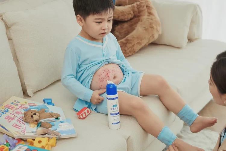 儿童肚子上经常长湿疹可以根治吗(图1)