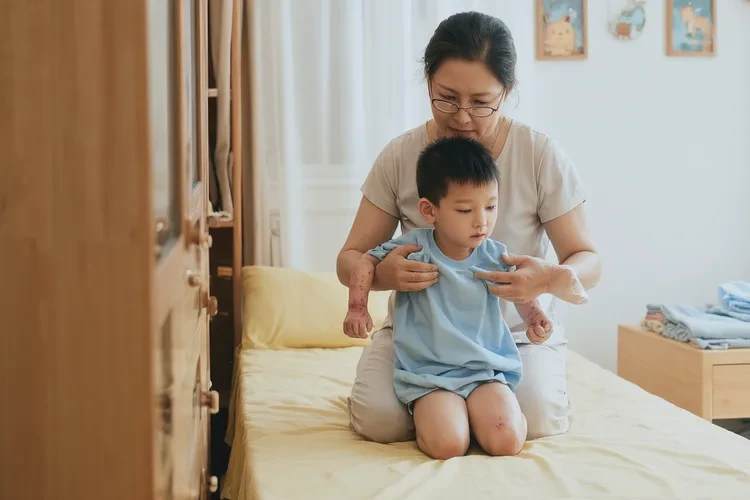 儿童手臂上偶尔长湿疹能够根治吗(图2)