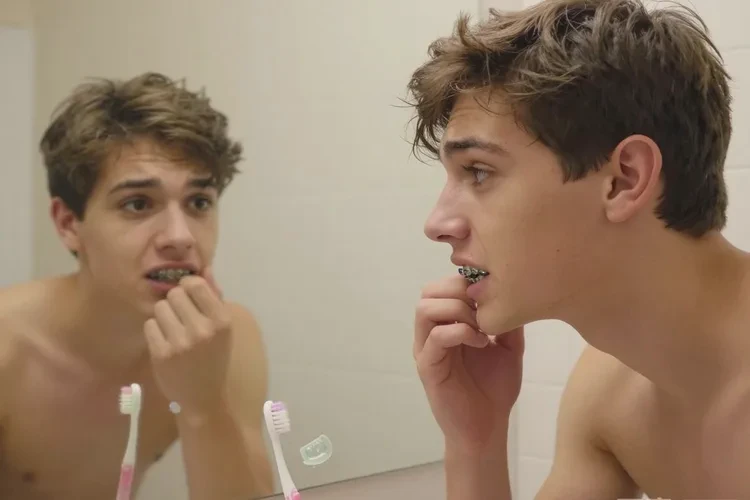 牙齒正畸過(guò)程中牙齒松動(dòng)了(圖2)