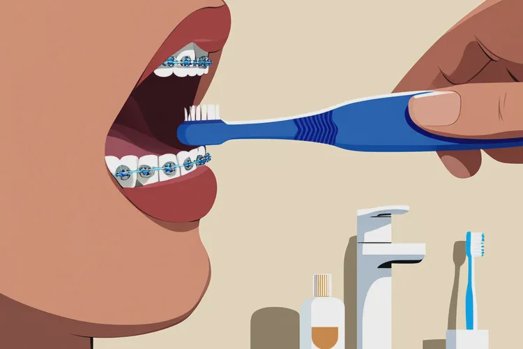 正畸牙齒松動(圖2)