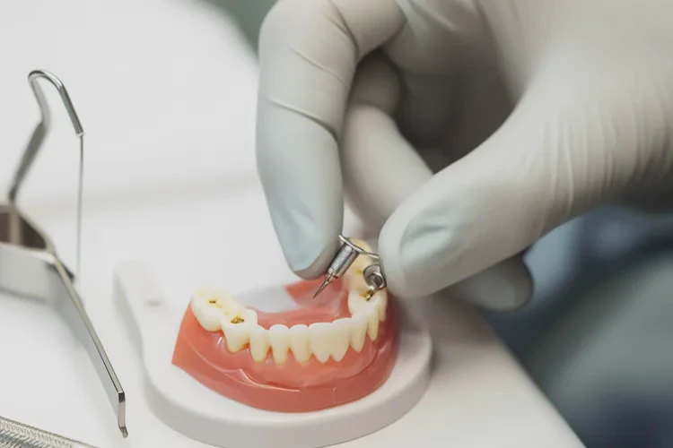 正畸牙齒移動塊好還是不移動好(圖2)