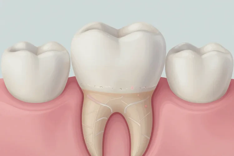 正畸牙齒松動(dòng)了怎么辦恢復(fù)正常(圖4)