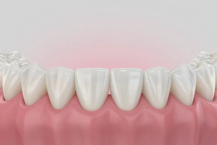 牙齒正畸費用一般多少成人(圖2)