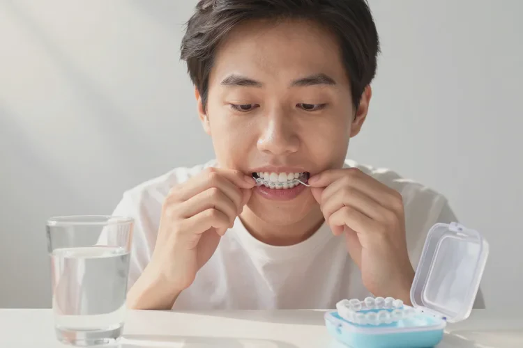 正畸牙齒排齊要多久恢復(fù)(圖3)