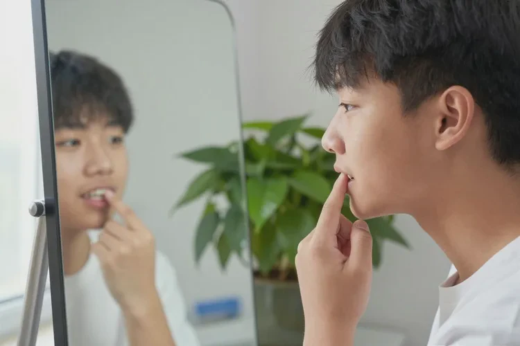 牙齒正畸先排齊后拔牙(圖3)