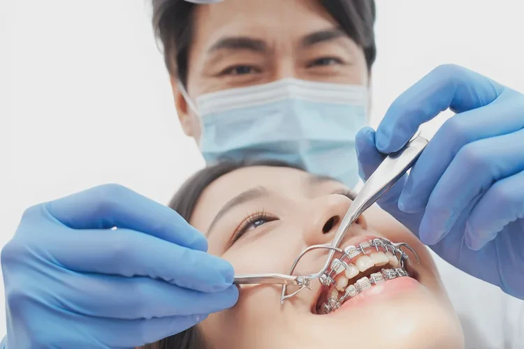 正畸牙齒移動(dòng)特點(diǎn)是什么樣的(圖1)