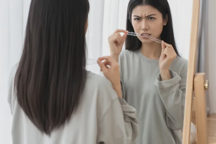 牙齒正畸皮筋會(huì)不會(huì)帶錯(cuò)(圖2)